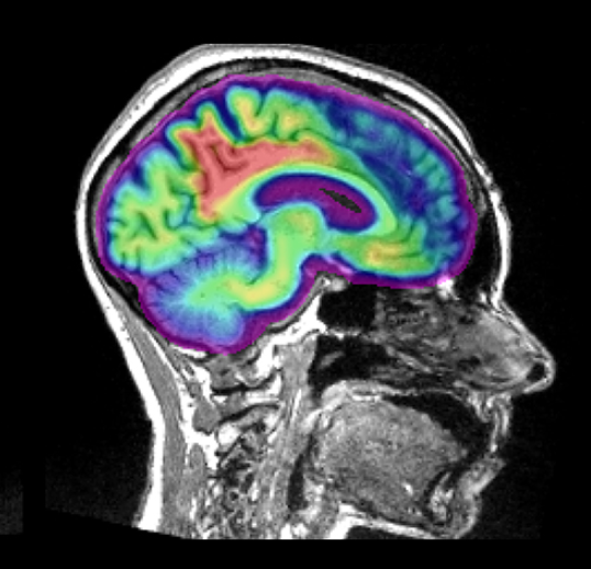 BrainSherpa App Interface