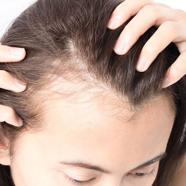Hair Fall Control