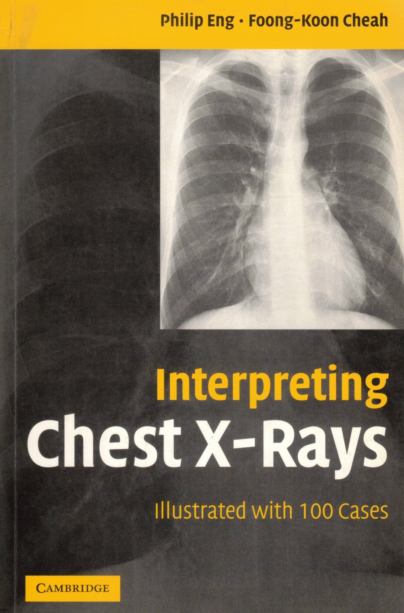 Interpreting Chest X-Rays (Illustrated with 100 Cases)